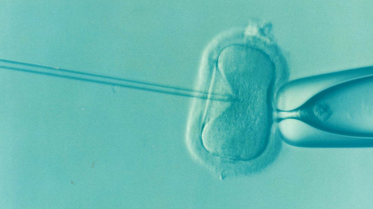 erfahren sie mehr über unfruchtbarkeit, ihre ursachen, symptome und mögliche behandlungsmöglichkeiten. informieren sie sich über die neuesten fortschritte in der fertilitätstherapie und erhalten sie wertvolle tipps für paare, die sich ein kind wünschen.