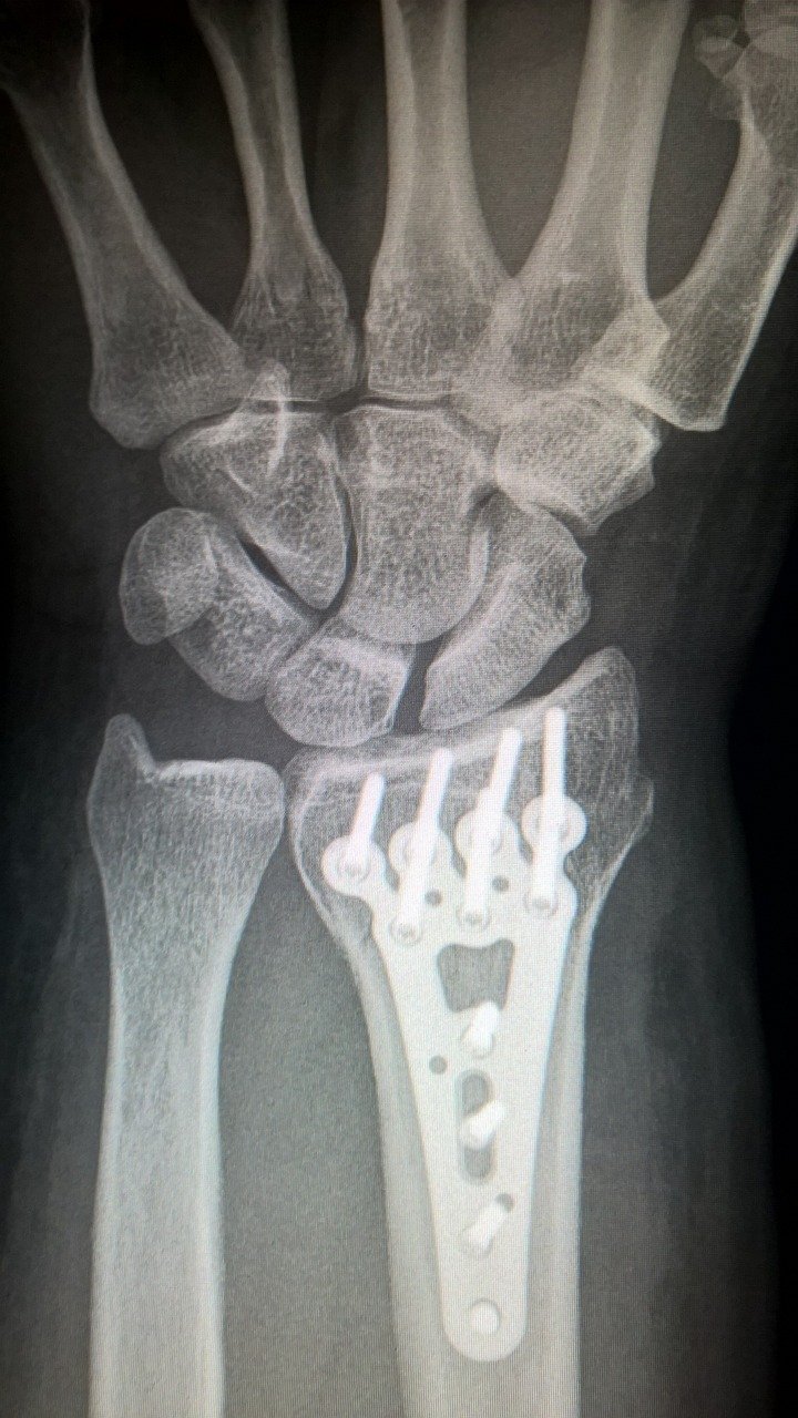 entdecken sie die vorteile der roboterassistierten chirurgie. präzisere eingriffe, schnellere genesung und minimale narben - erfahren sie, wie moderne technologie die chirurgie revolutioniert.