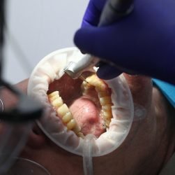 entdecken sie die besten tipps und produkte für eine optimale mundhygiene. erfahren sie, wie sie ihre zähne und ihr zahnfleisch gesund halten können, um ein strahlendes lächeln zu bewahren.