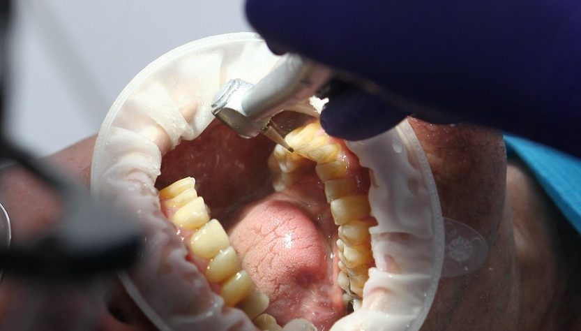 entdecken sie die besten tipps und produkte für eine optimale mundhygiene. erfahren sie, wie sie ihre zähne und ihr zahnfleisch gesund halten können, um ein strahlendes lächeln zu bewahren.