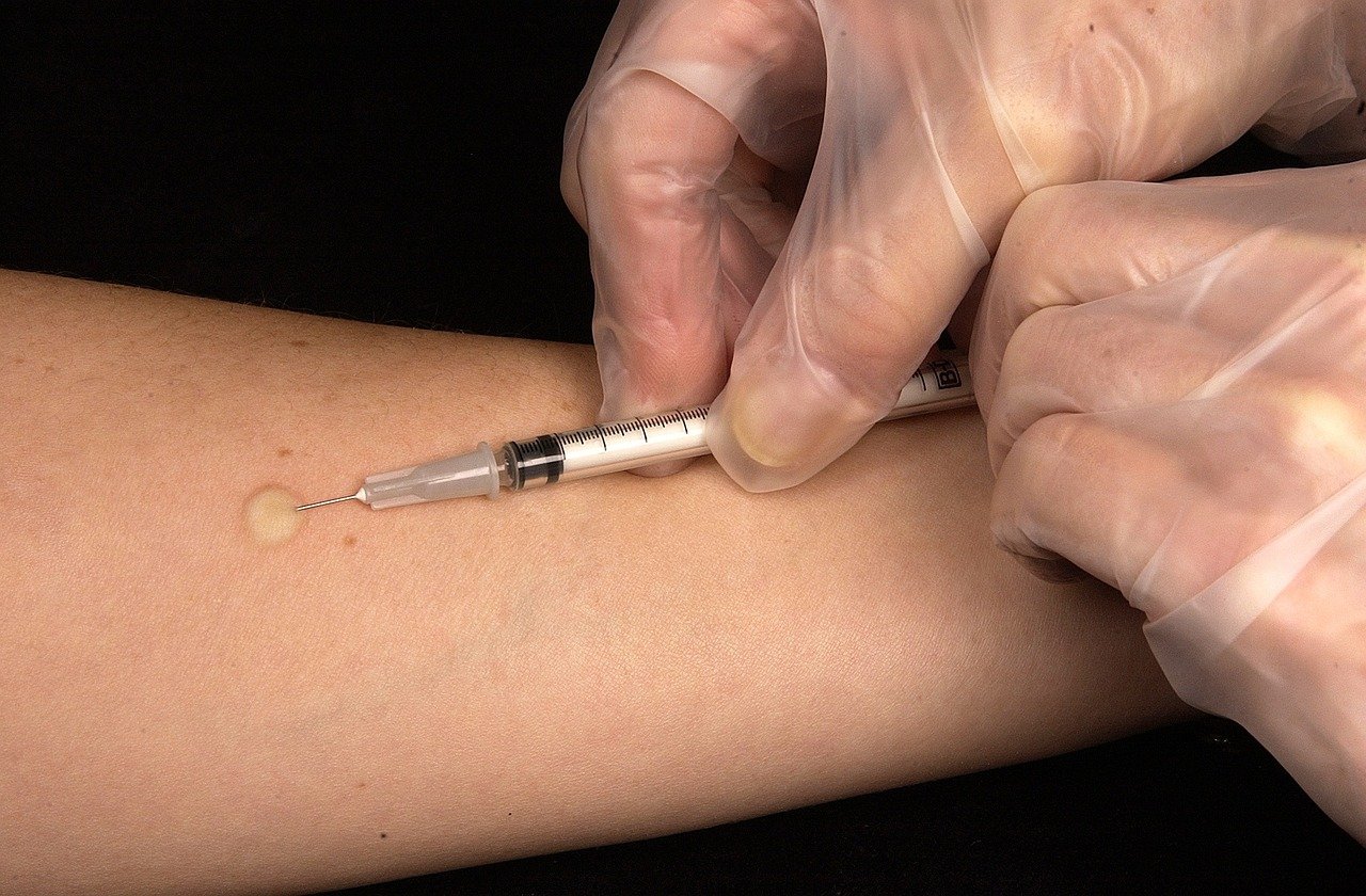 erfahren sie alles wissenswerte über tuberkulose: ursachen, symptome, übertragung und behandlungsmöglichkeiten. bleiben sie informiert und schützen sie ihre gesundheit mit aktuellen informationen rund um die infektionskrankheit tuberkulose.