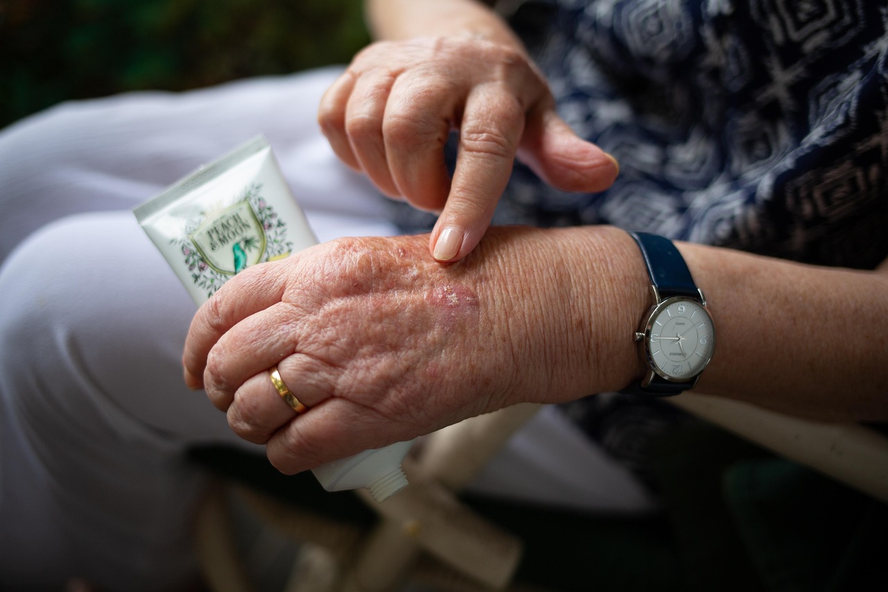 erfahren sie alles über arthritis – ursachen, symptome und behandlungsmöglichkeiten. informieren sie sich über moderne therapien, tipps zur linderung von gelenkschmerzen und wie sie ihre lebensqualität verbessern können.